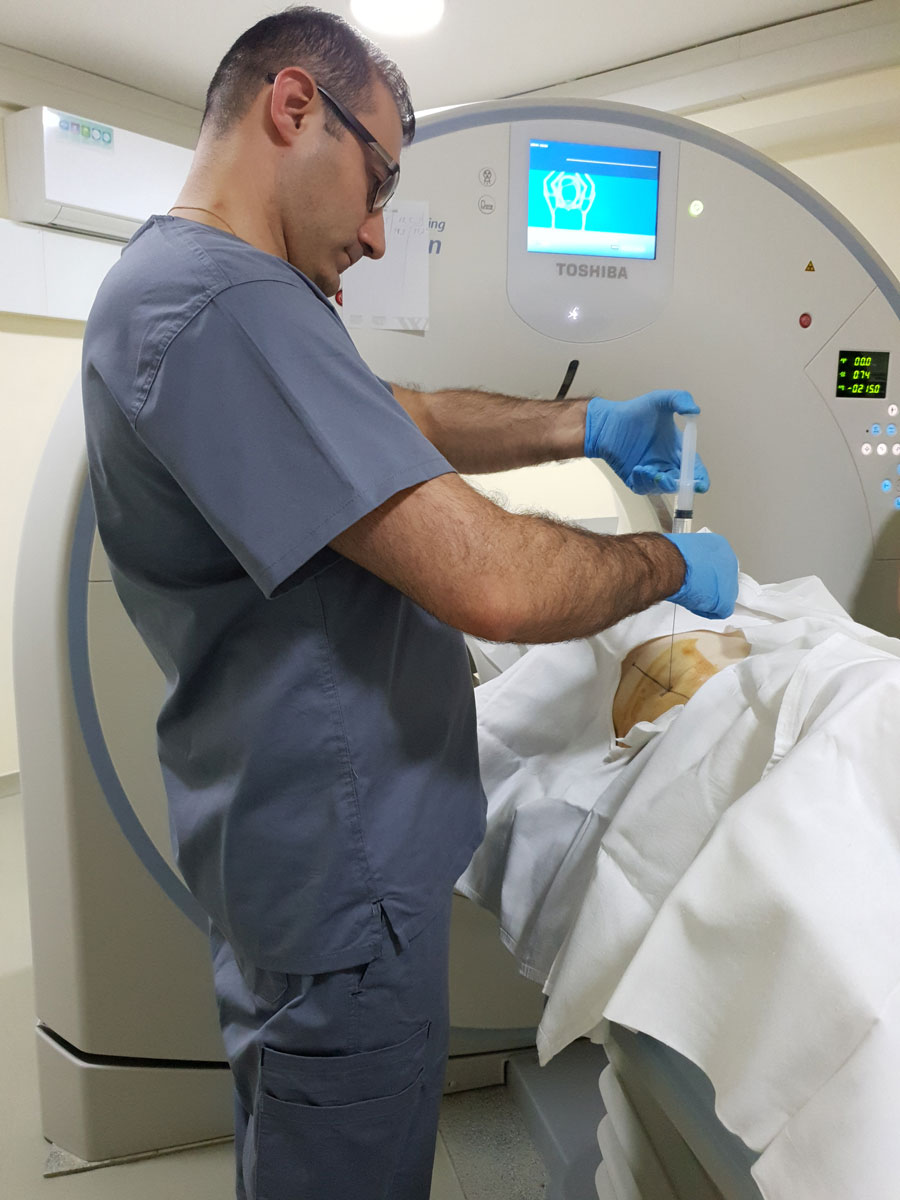 Dr Galumyan performing CT guided abscess drain